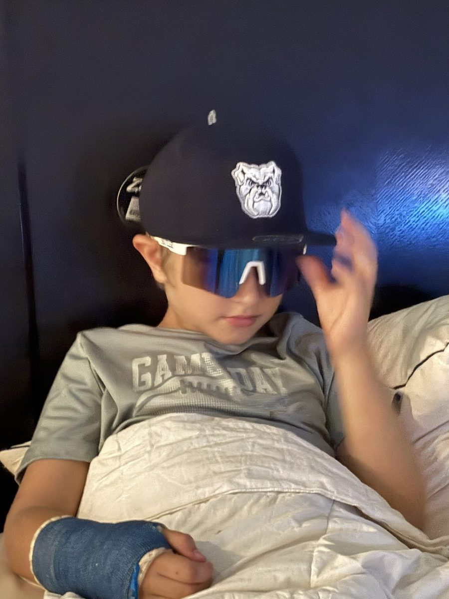 Nolan in a Butler Bulldogs cap and sunglasses with a cast on his arm.